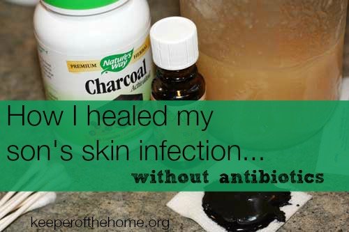 How do you heal raw skin?